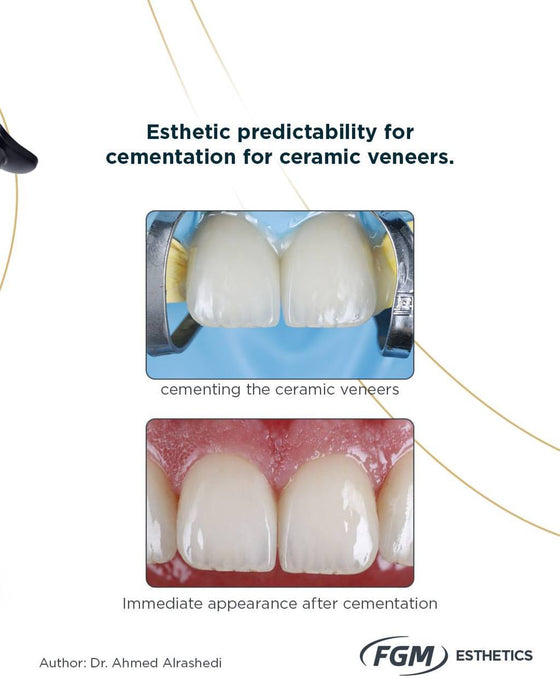 Allcem Veneer APS